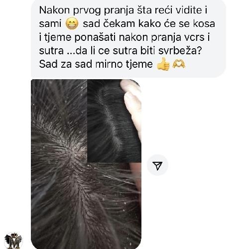 image(20) â kopija