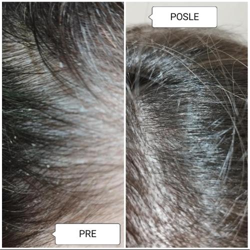 image(18) â kopija