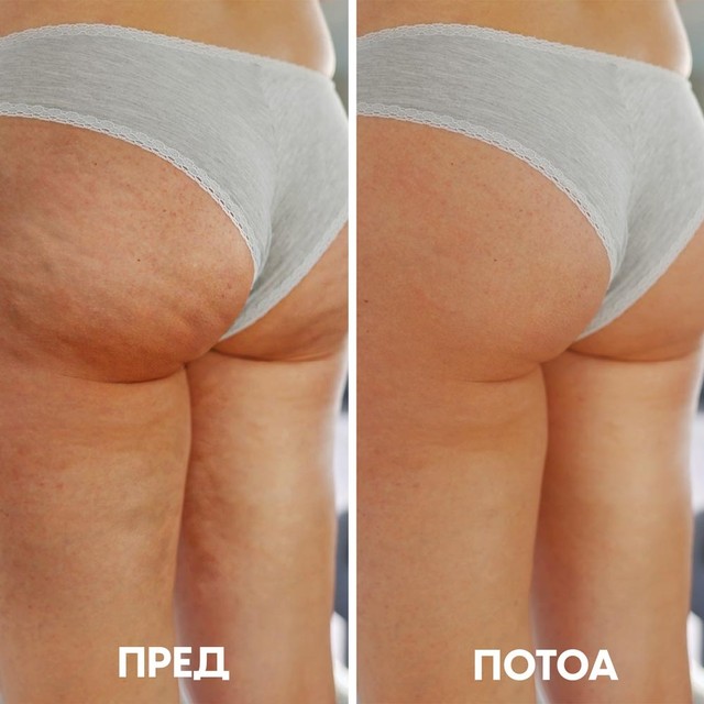 before-after---slajd---topform-MK