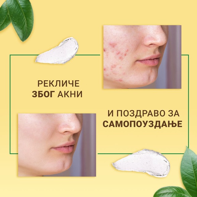 SOS-CINK---SLAJD--MK