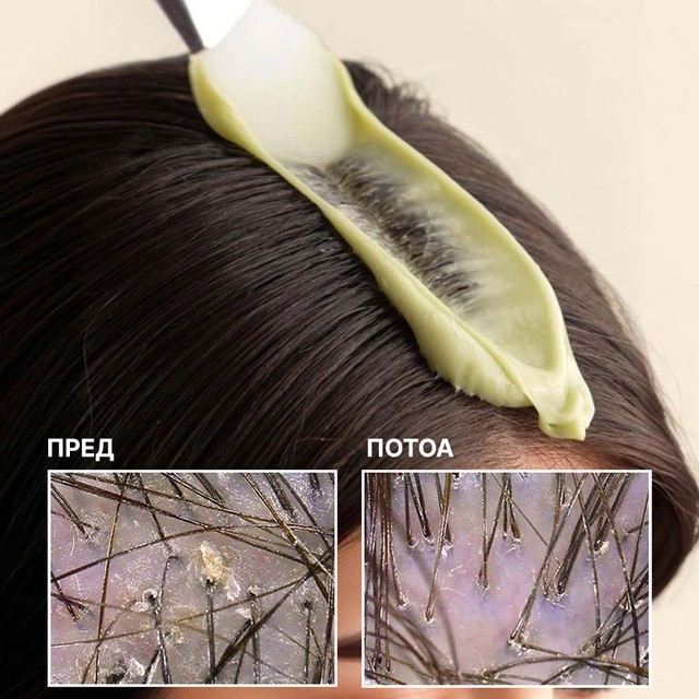 slajd-DETOX--pre---posle