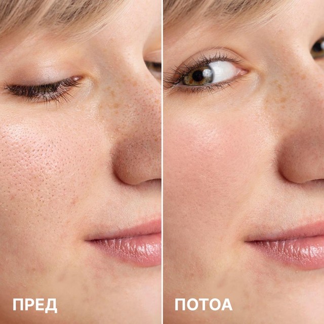 AHA-SERUM-pre-posle---MK