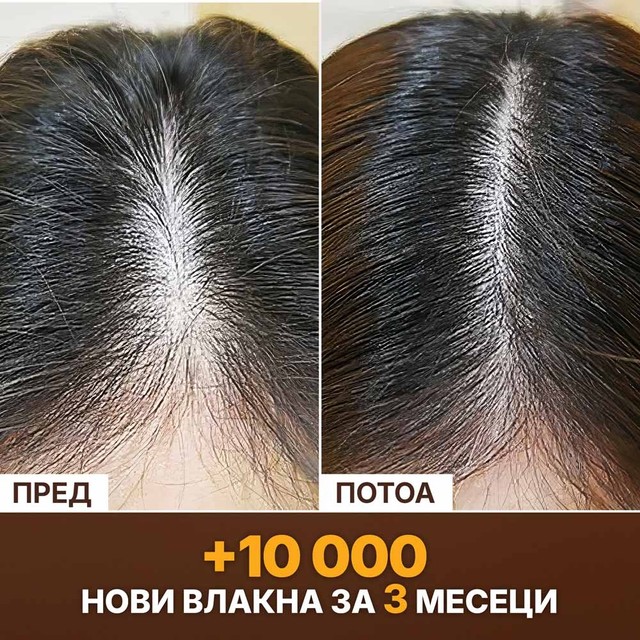 SLAJD-6----PRIJE-POSLIJE